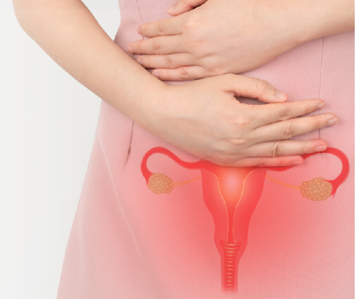 Endometriosis and Adenomyosis: Understanding Symptom Overlap, Challenges in Diagnosis and Treatment Options